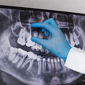 a dentist looking at an X-ray of a mouth