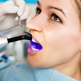 Close up of dentist using a light to cure patient’s cosmetic bonding