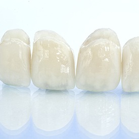 All-ceramic dental bridge