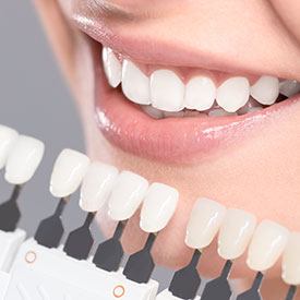 teeth whitening in Petaluma California