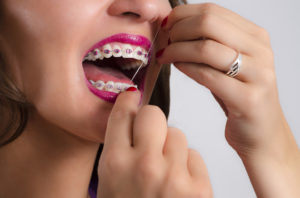 braces flossing woman