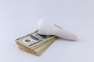 Are dental implants worth the cost?