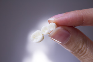 Three dental crowns sitting in a row on a black reflective surface
